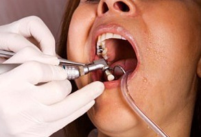 Dental mercury on American Indian reservations
